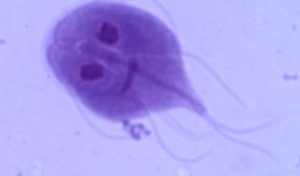 Read more about the article Giardiasis